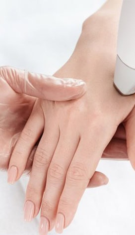 REJUVENECIMIENTO DE MANOS